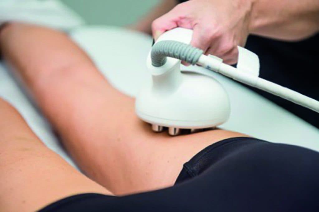 Cellulite 101: Was Sie wissen müssen