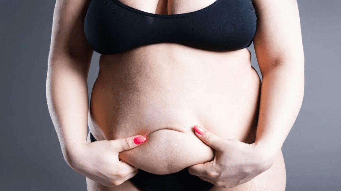 Lipödem Behandlung im Vergleich: Welche Therapien sind am effektivsten?