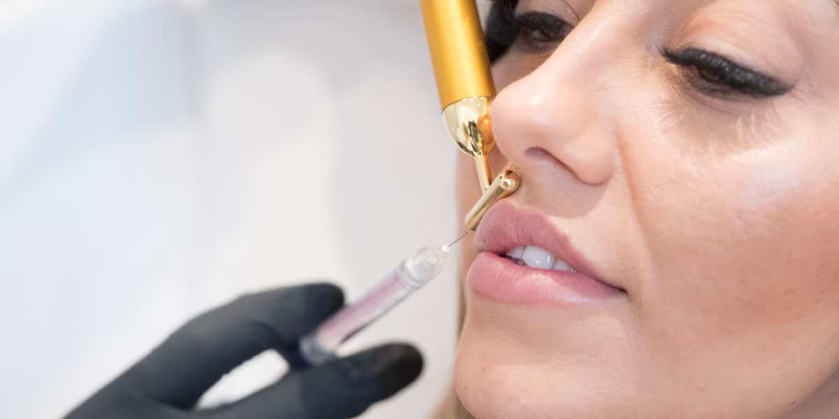 MY AESTHETICS – Ihre Adresse für Lippen Aufspritzen Nürnberg