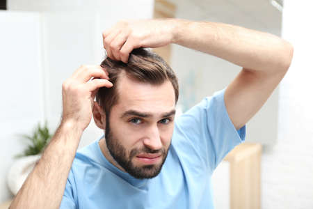 Haartransplantation: Top 9 nützliche Tipps