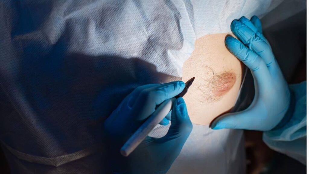 Brustvergrößerung mit Straffung: Ein umfassender Leitfaden für Frauen