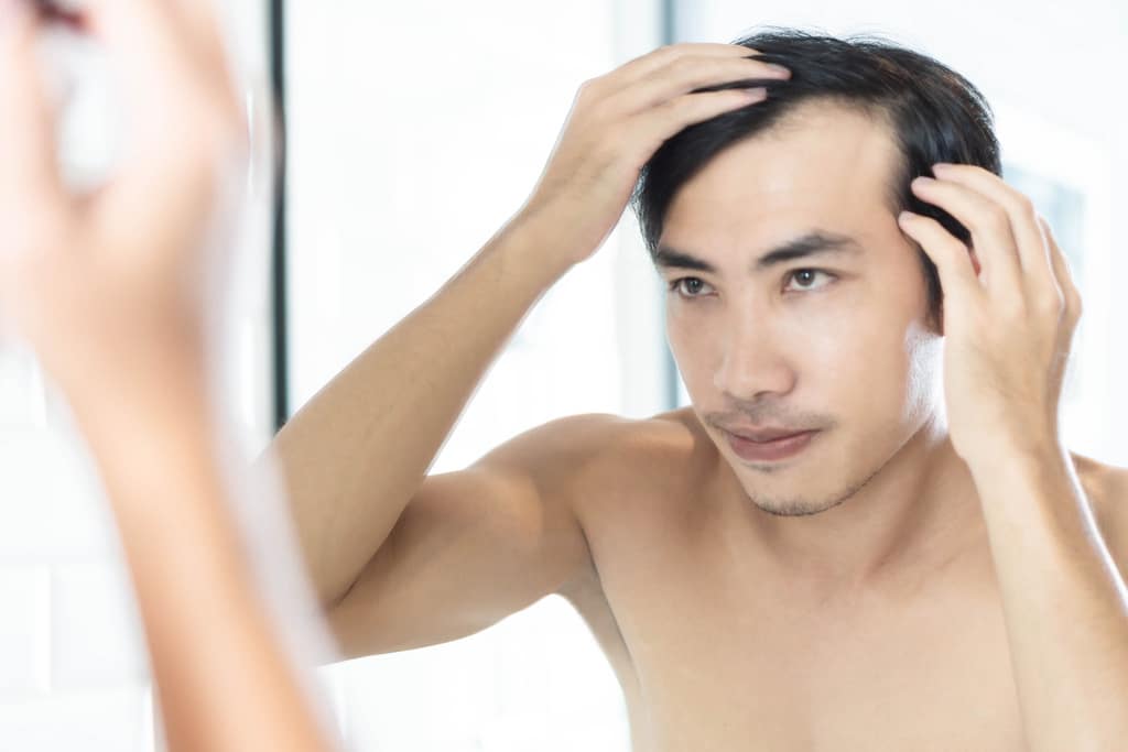 Haartransplantation: Natürliches Aussehen dank moderner Technologie