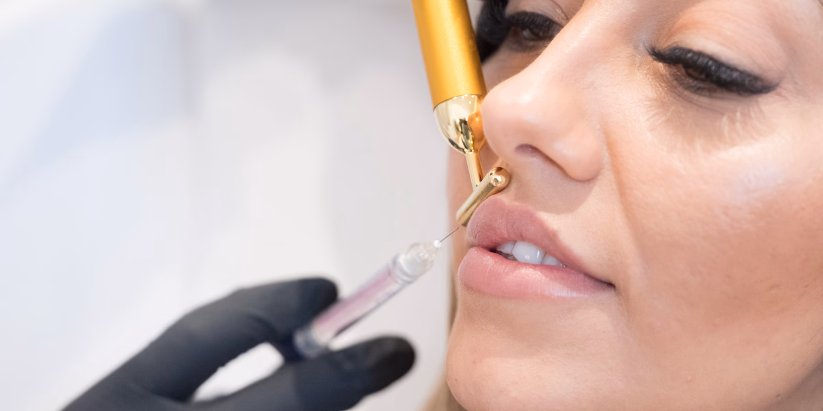 MY AESTHETICS – Ihre Adresse für Lippen Aufspritzen Nürnberg